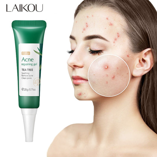 LAIKOU Tea Tree Acne Cream Anti-Acne Oil Control Repair Fade Acne Spots Shrink Pores Whitening Moisturizing Face Gel Skin Care
